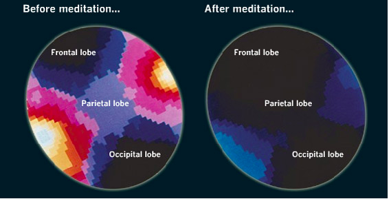 yönlendirmeli meditasyon